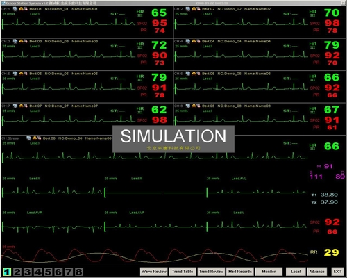 sistema di controllo centrale del monitor paziente del lato del letto portatile